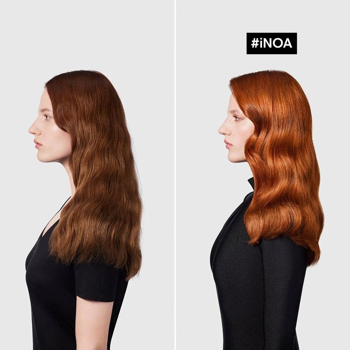 Inoa loreal